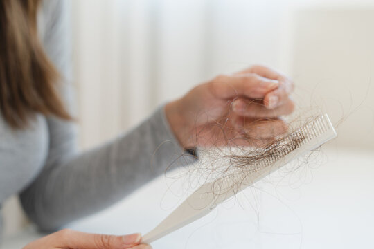 Hair fall problem concept. Shocked Asian woman looking at many hair lost in her hand and comb.
