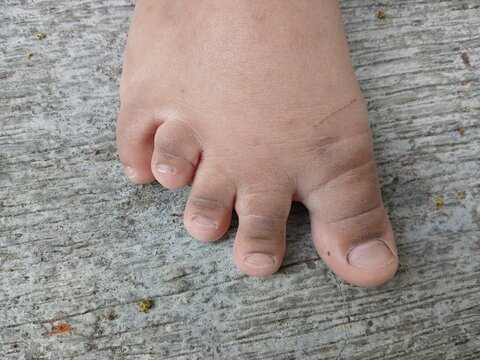 Close-up View of Child's Toes