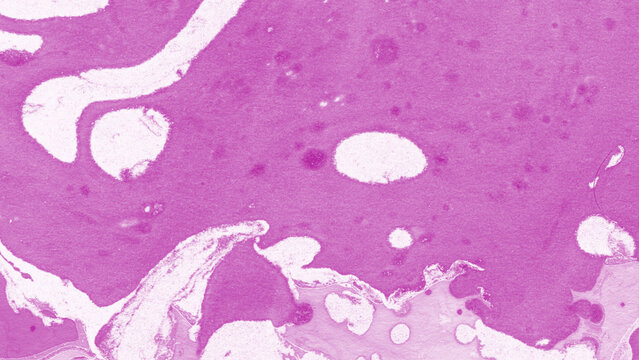 Microscopic View of Stained Bone Histology Section Showing Trabecular Bone Matrix and Osteocytes