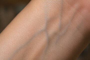 Fototapeta premium A close-up of human skin revealing a visible stretch mark on an arm.