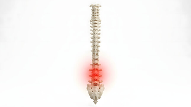 Human spine with lower back pain highlighted
