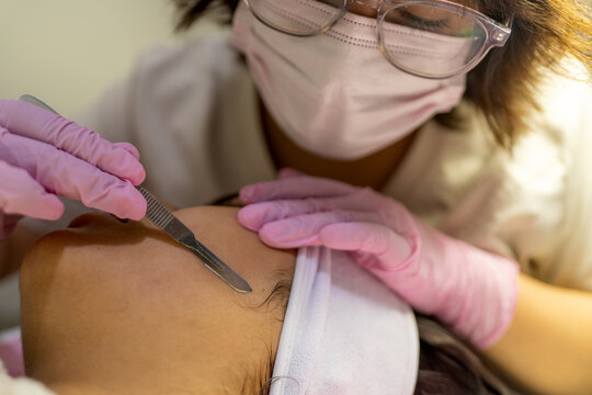 Specialist performing facial dermaplaning treatment at clinic