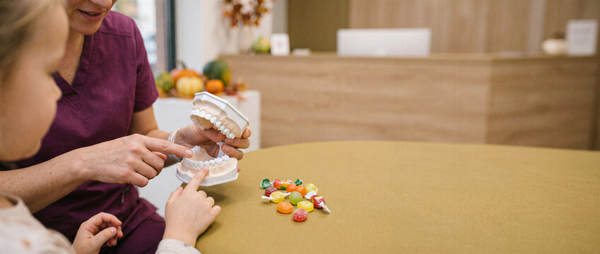 Close Up Dental Model and Halloween Candy for Pediatric Sugar Awareness and Cavity Prevention