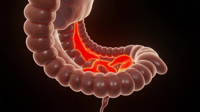 Jejunal Mucosal Folds in Hybrid Endoscopy Visualization for Medical Education