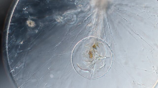 Ocean Sparkle Noctiluca Cells under the Microscope
