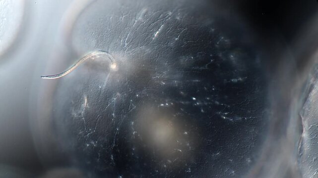 Ocean Sparkle Noctiluca Cells under the Microscope