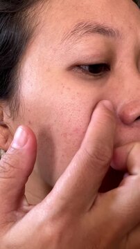 Slow motion vertical close up video of a woman touching her cheek, feeling the onset of blackheads, enlarged pores, and dark spots on her facial skin. Examining skincare concerns.