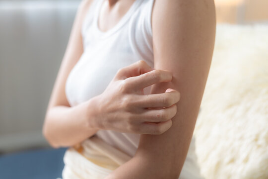 Close-up of woman scratching itchy skin on her upper arm at home, showing irritation, allergy, rash, discomfort, dermatology, sensitive skin, healthcare and skin problem concept.