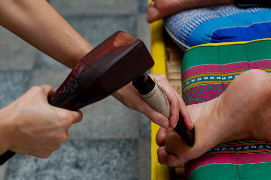 Hammer Massage therapy (Tok Sen) session in Thailand