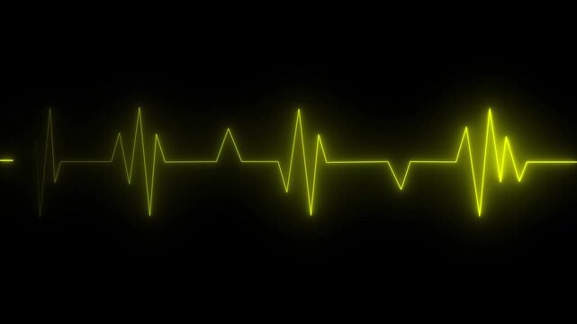 Neon yellow ekg heartbeat line animation on black background, medical pulse monitor loop, healthcare technology concept
