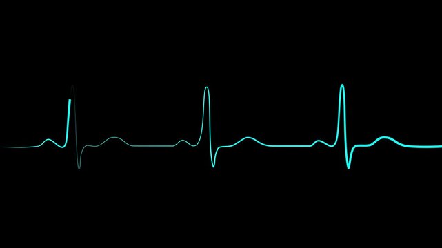 Heart beat cardiogram on ecg illustration. black background. Motion Graphic concept. animation