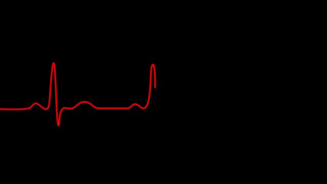 Heart beat cardiogram on ecg illustration. black background. Motion Graphic concept. animation
