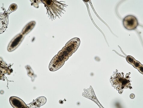 Microscopic view reveals diverse soil organisms like amoeba nematodes and fungi. Tiny life forms in water sample show complex structures vital for ecosystem health.