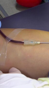 Blood donors. Women giving blood for medical charity program - Vertical Video