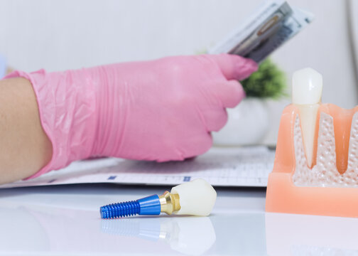 Payment for expensive dental services and prosthetics illustrated by a macro tooth implant and a doctor holding money over medical paperwork.
