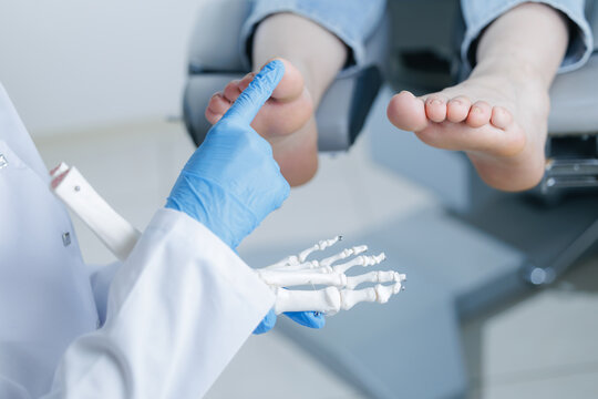 Podiatrist doctor showing foot skeleton model on background injured leg of patient in traumatology clinic