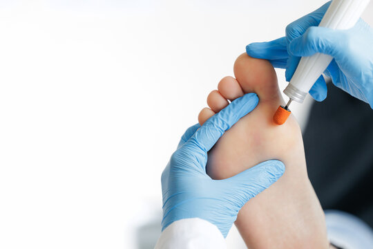 Podiatrist treating patient foot with specialized equipment, banner pedicure