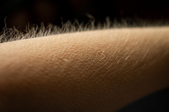 Detailed macro close-up of goosebumps on human skin, with fine body hair standing on end. A tactile texture illustrating physical responses to cold, fear, excitement, emotion and sensory stimulation.