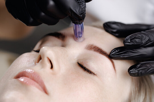 Woman receiving microneedling treatment on eyebrow area