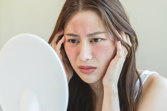 Asian young woman looking face skin in the mirror have a red rash on her face from cosmetic allergy