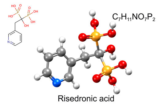 Structure of residronic acid, a medicine for osteoporosis.  Chemical formula, structural formula, and 3D ball-and-stick model.