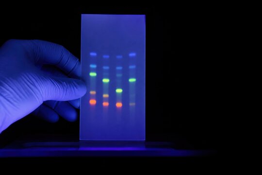Hand holding TLC plate with fluorescent bands under UV light