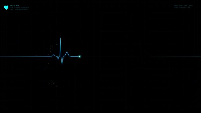 Dynamic electrocardiogram (ECG) monitor showing a pulsing heartbeat signal. Medical science, cardiology, and health technology motion graphics loop.