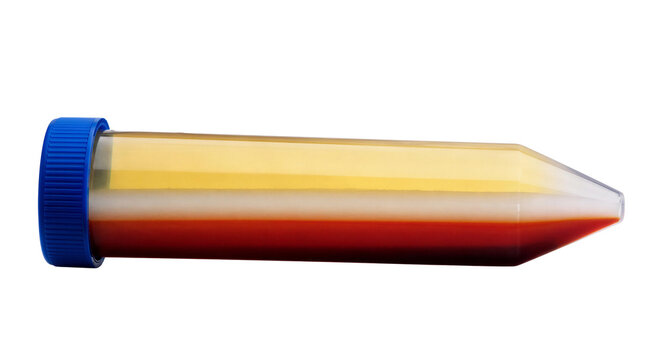Blood Sample Separation in a Centrifuge Tube