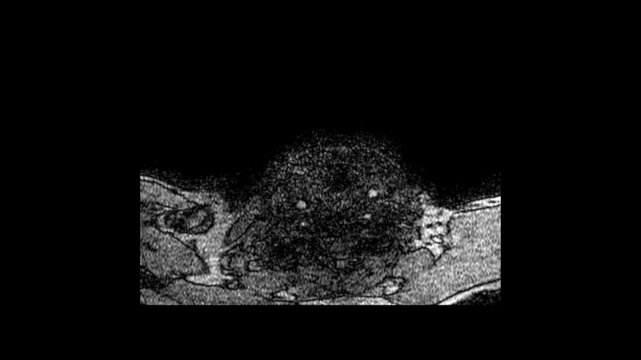 Sagittal Brain and Profile MRI Scan Sequence