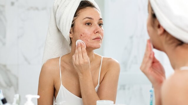 Young woman with towel turban treating acne with a cotton pad in front of a bathroom mirror during a skincare routine