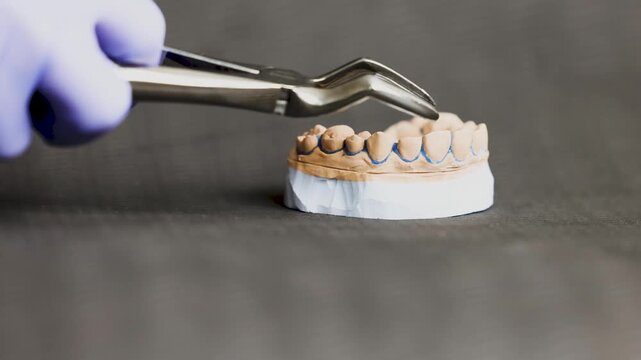 Gloved hand using stainless steel dental extraction forceps on plaster tooth model with blue orthodontic wire outline, close-up dental education demonstration on dark textured stone table background