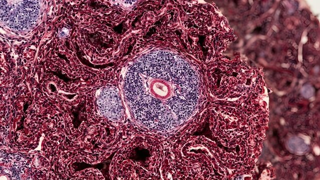 Microscopic view of a human seminiferous tubule cross-section showing germinal epithelium and surrounding connective tissue.