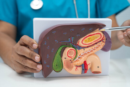 Cirrhosis, Liver cancer, fatty liver, Asian doctor with liver human anatomy model in World Hepatitis Day at hospital.