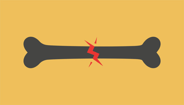 Graphic representation of a broken bone showing a red lightning bolt in the fracture point over a solid yellow background.