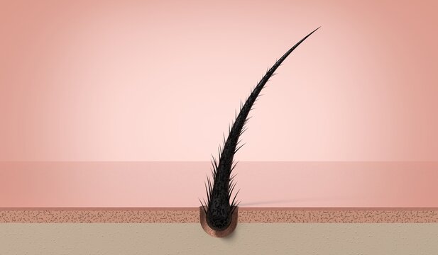Damaged dry single hair strand growing from scalp follicle - 3d illustration