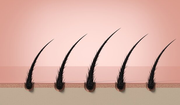 Row of multiple damaged weak hair strands growing on scalp - 3d illustration