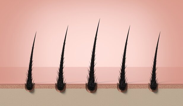 Multiple damaged hair strands with split ends on skin - 3d illustration