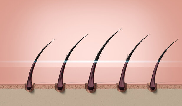 Row of multiple hair strands growing from skin scalp layer - 3d illustration