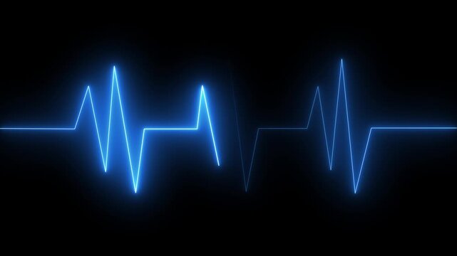 Monitoring in an emergency ecg line animation. heartbeat signal icon cardiogram motion graphics. Medical concept EKG Pulse Wave. 4k video..

