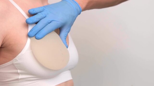 Plastic surgeon applying a breast implant template or checking size on a female patient, healthcare advertising, plastic surgery, consultation.