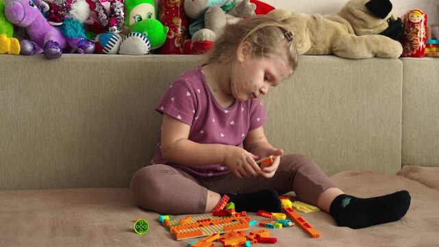 A little girl with chickenpox is playing at home with a construction kit. The child is in home isolation. Chicken pox.