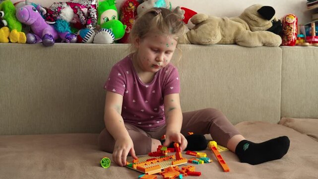 A little girl with chickenpox is playing at home with a construction kit. The child is in home isolation. Chicken pox.