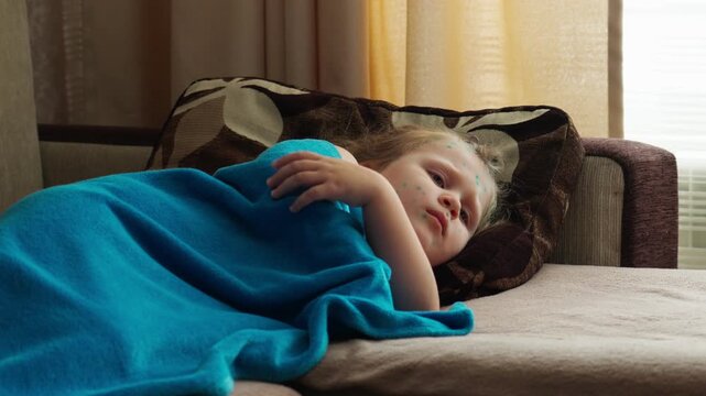 A little girl with chickenpox lies sadly at home, covered with a blanket.  The child is in home isolation. Chicken pox.