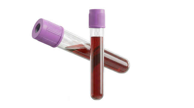 Two purple capped blood test tubes with samples for medical analysis.