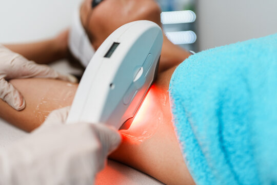 Cosmetologist using modern diode laser equipment for underarm hair removal treatment on a female client in a beauty salon.