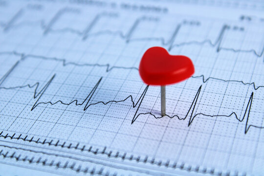 Heart-shaped pin marking a point on an electrocardiogram