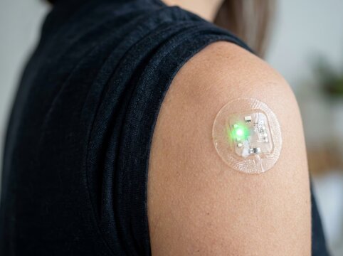 Woman wearing wearable medical biosensor patch on shoulder. Smart device for continuous health monitoring and biometric data transmission. Future healthcare and clinical technology.