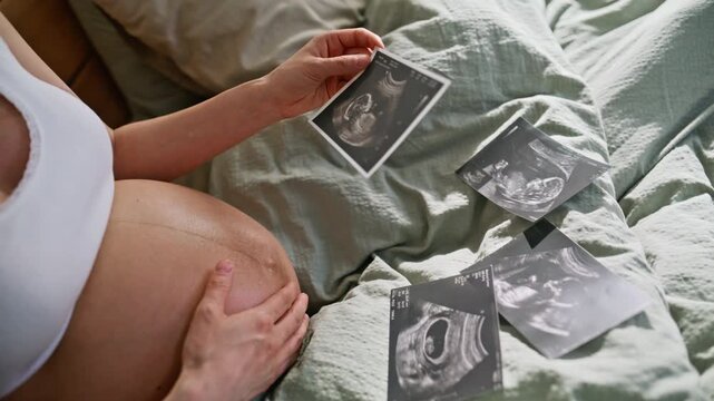 Close up sonogram photos pregnant belly. Woman holding ultrasound scan bed home.