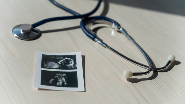 Photo: Ultrasound screening of a child and stethoscope. Image of an embryo.
