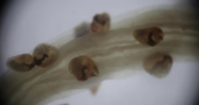 Freshwater Trematode Parasites: Clinostomum, Postorchigenes and Thapariella spp. for education in Lab.